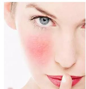 拿什么拯救你，紅血絲小姐