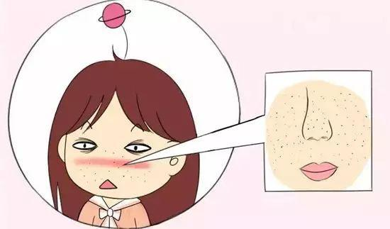 女生毛孔粗大到底應該怎么辦？